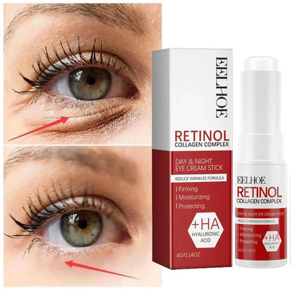 Retinol Wrinkle Remover Face Set