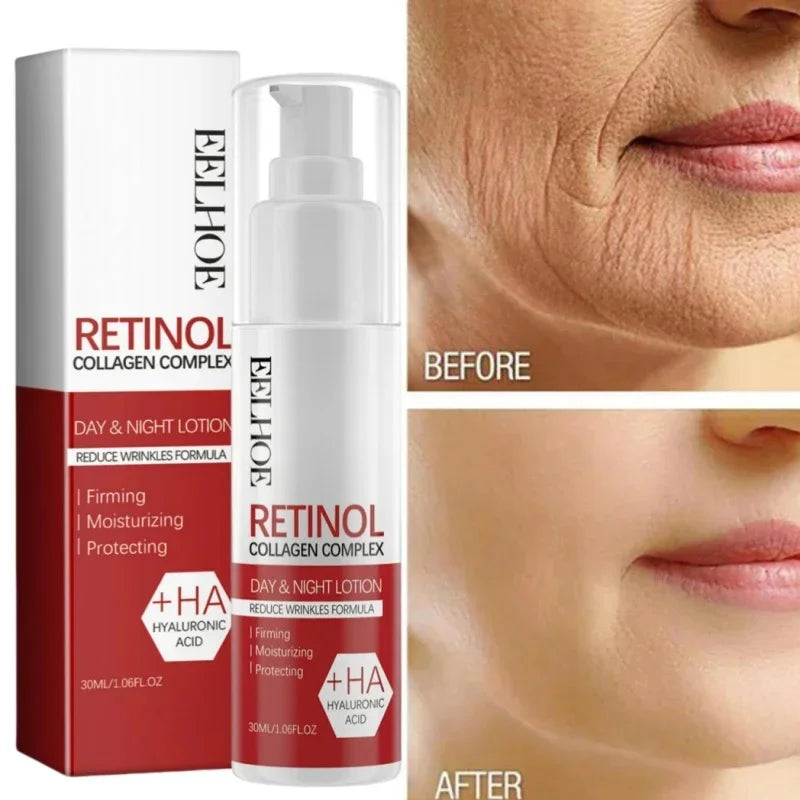 Retinol Wrinkle Remover Face Set