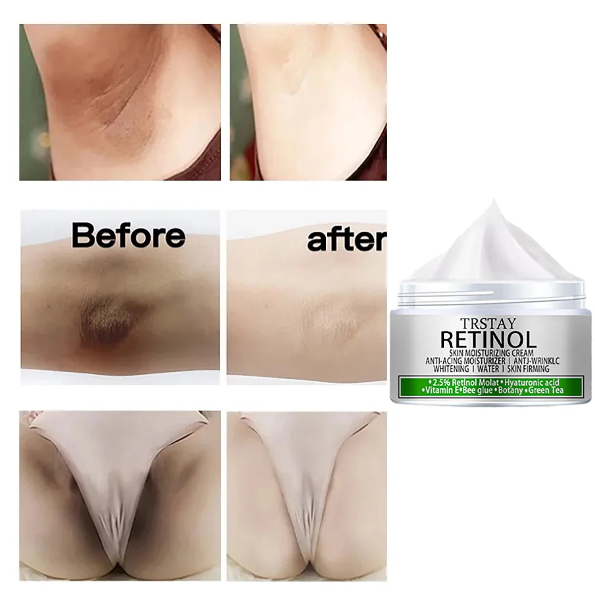 Underarm Armpit Whitening Cream