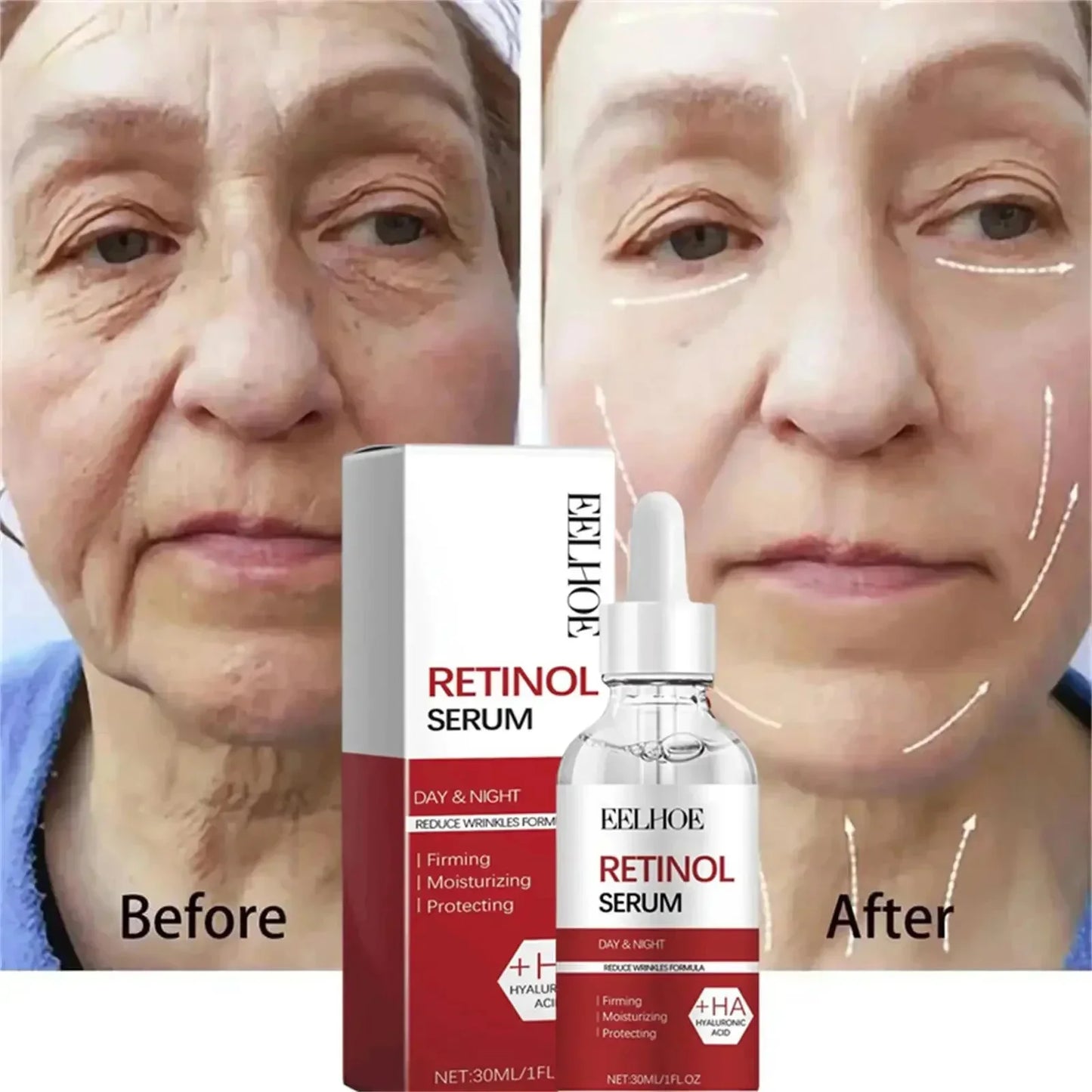 Retinol Wrinkle Remover Face Set