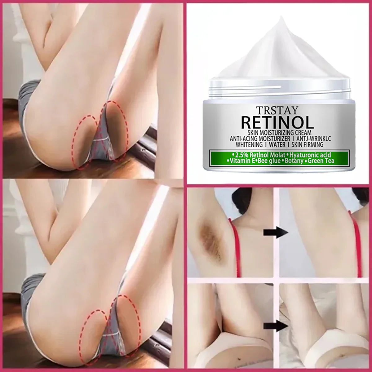 Underarm Armpit Whitening Cream