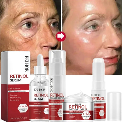 Retinol Wrinkle Remover Face Set