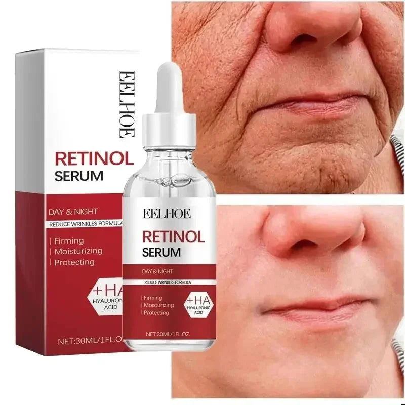 Retinol Wrinkle Remover Face Set