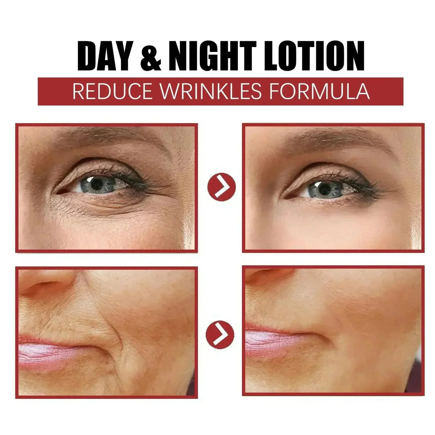 Retinol Wrinkle Remover Face Set