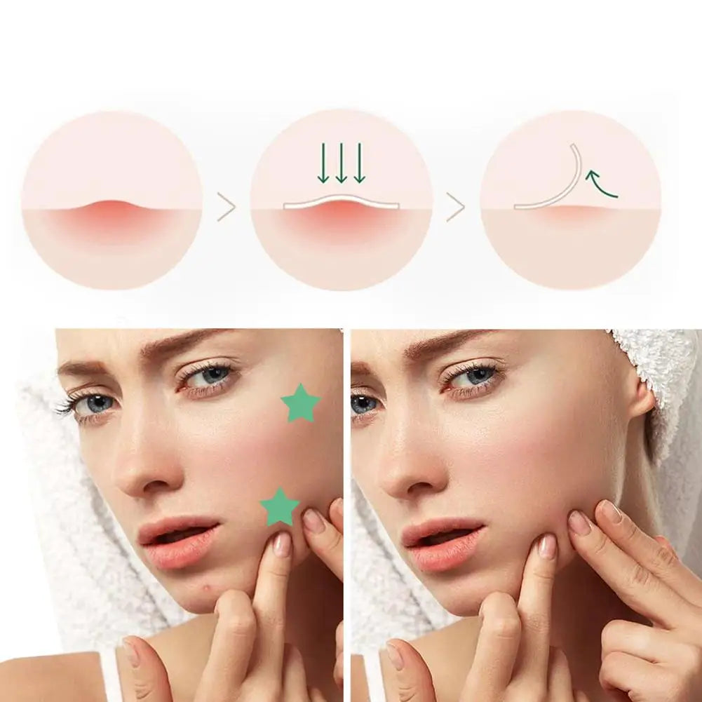 Invisible Acne, Pimples & Blackheads Reduce Patch