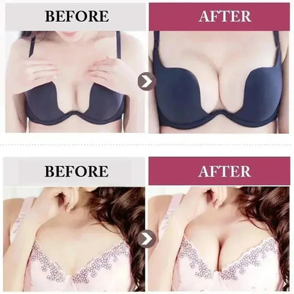 Natural Breast Enlargement Crea